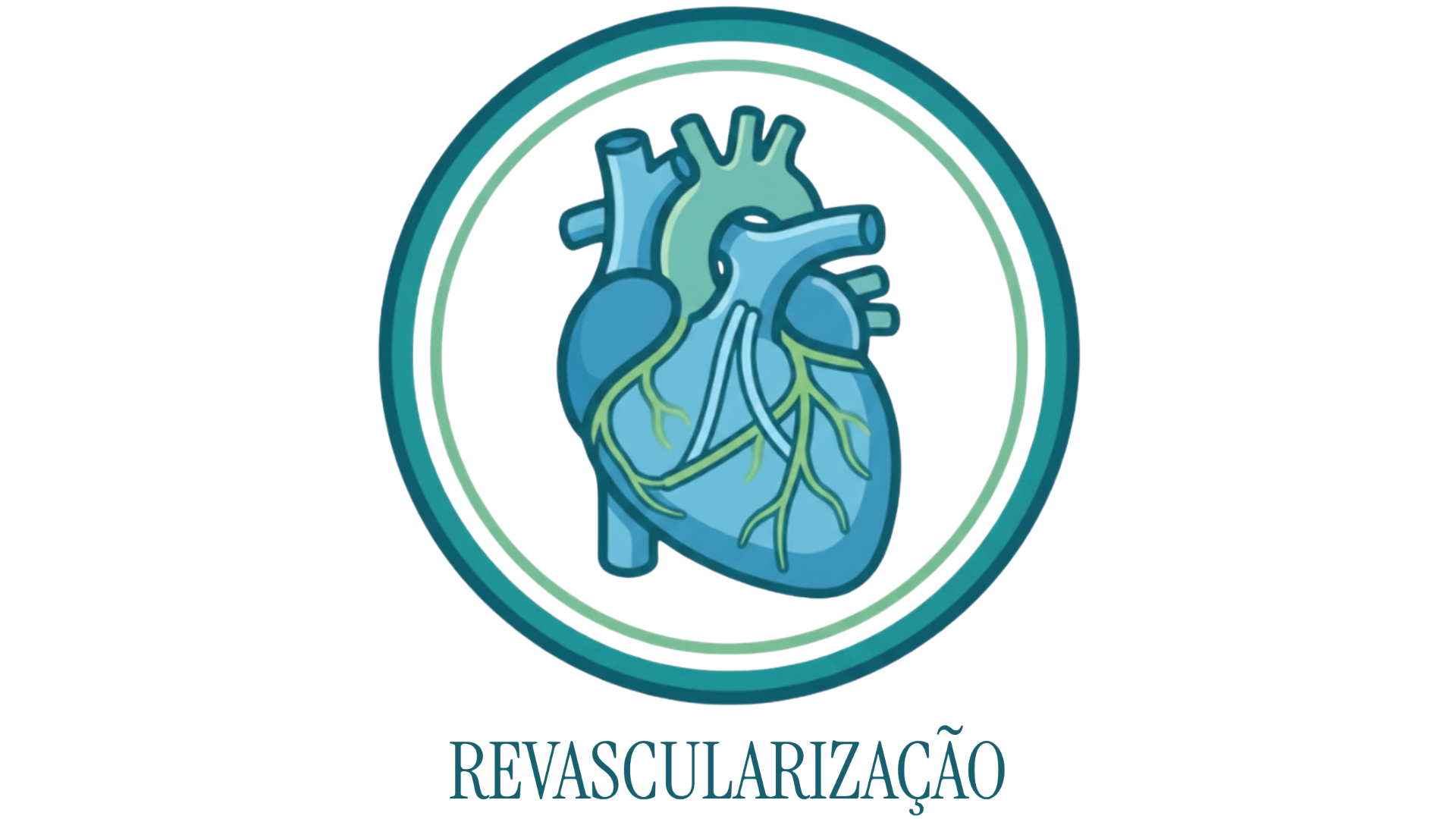 Revascularização do Miocárdio