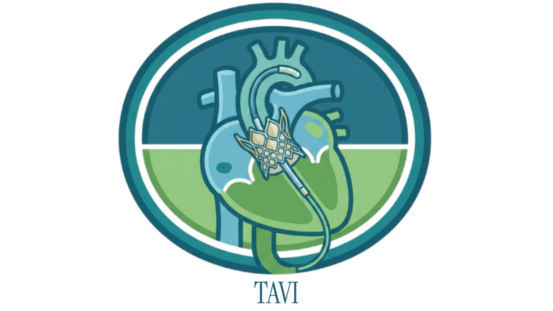 TAVI